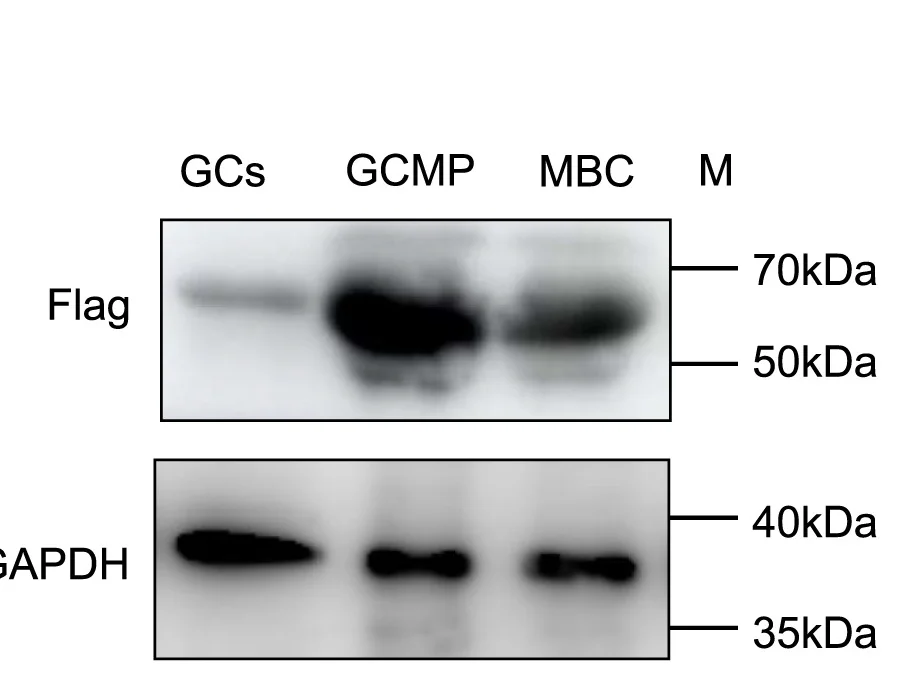Open access visualization of Gel, ZBTB18 Protein Expression, Western Blotting