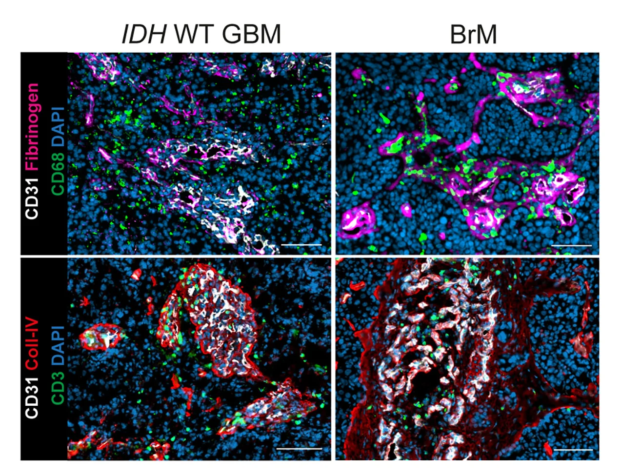 Open access visualization of Microscopy, IF Images, ECs, Myeloid Cells, T Cells