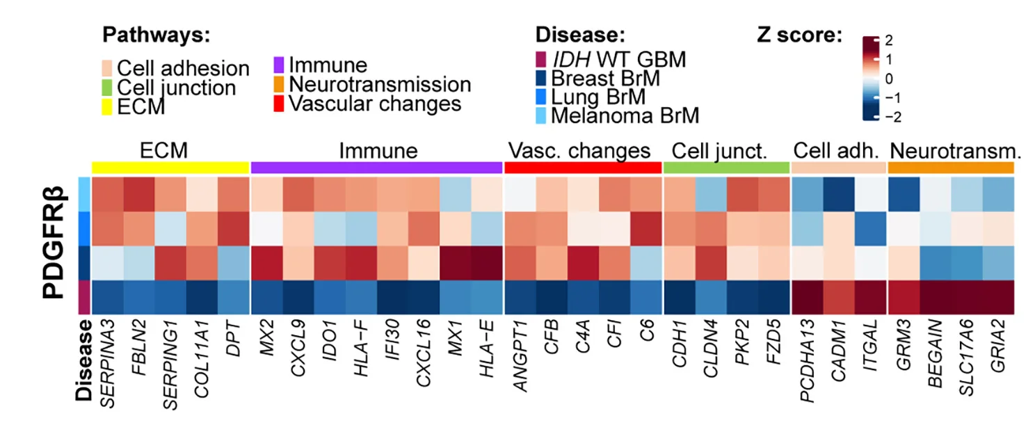Open access visualization of Heatmap, DEGs, IDHWT GBM, BrM, Mural Cells