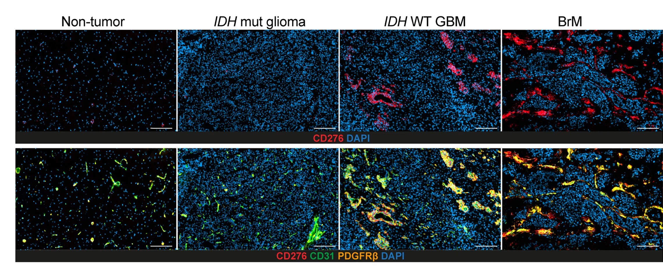 Open access visualization of Microscopy, IF Images, Vascular CD276 Staining, Vasculature Area, CD31