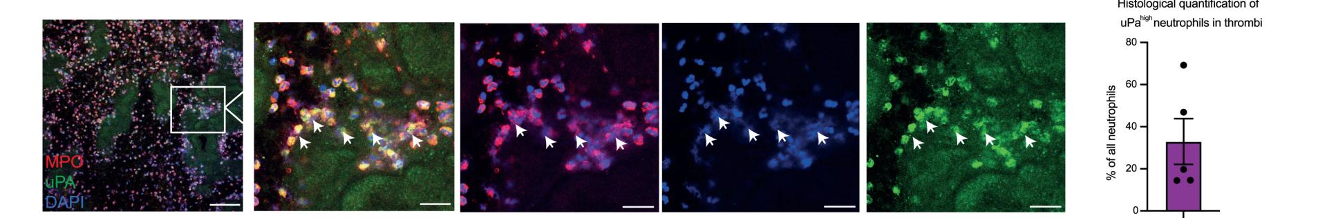 Open access visualization of Microscopy, Bar Plot, Error Bars, Immunofluorescence Imaging, tNeutros