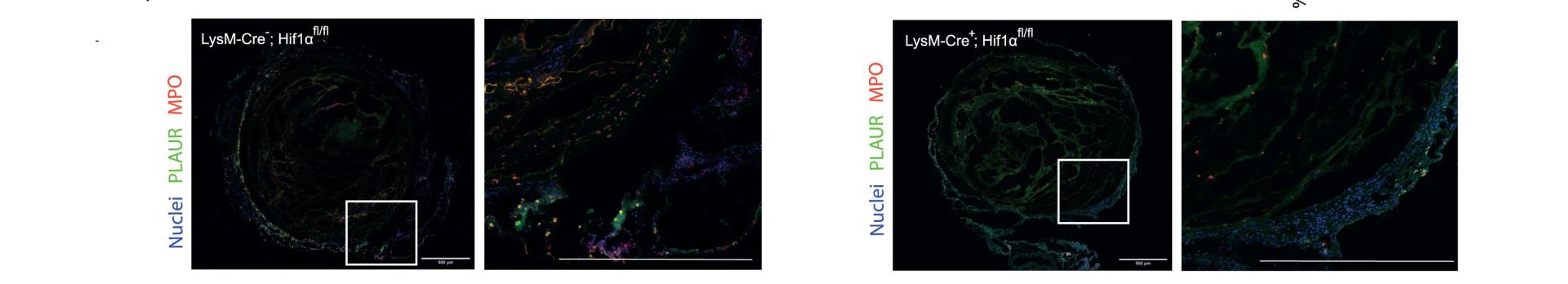 Open access visualization of Microscopy, Lyz2-cre;HIF1alphafl/fl Chimera, Thrombi, Hoechst Staining, MPO