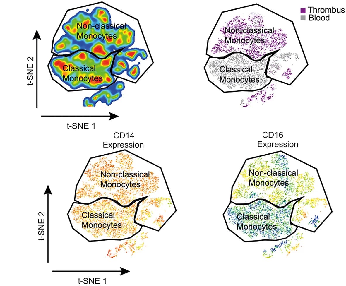 Open access visualization of Scatter Plot, UMAP, t-SNE, Dimensionality Reduction, Monocyte