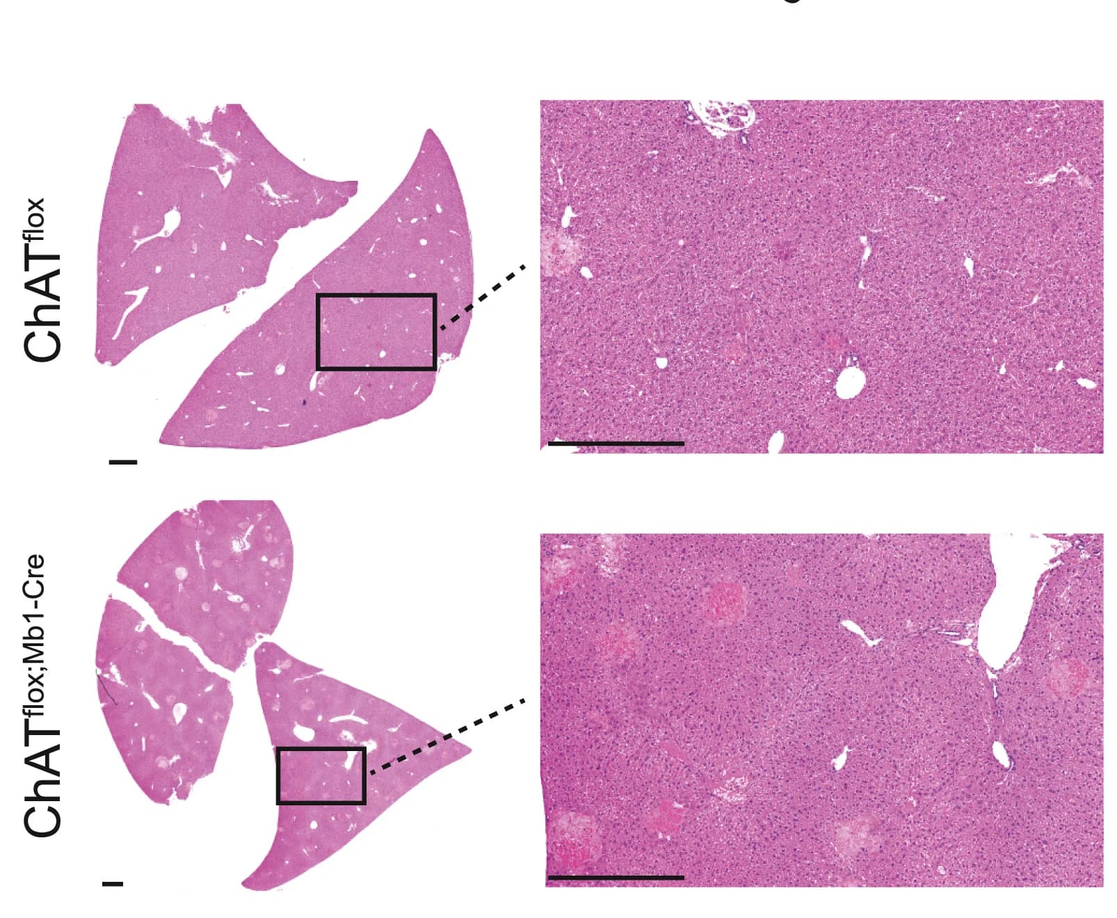 Open access visualization of Microscopy, H&E Staining, Liver Sections, ChATflox Mice, ChATflox;Mb1-Cre Mice
