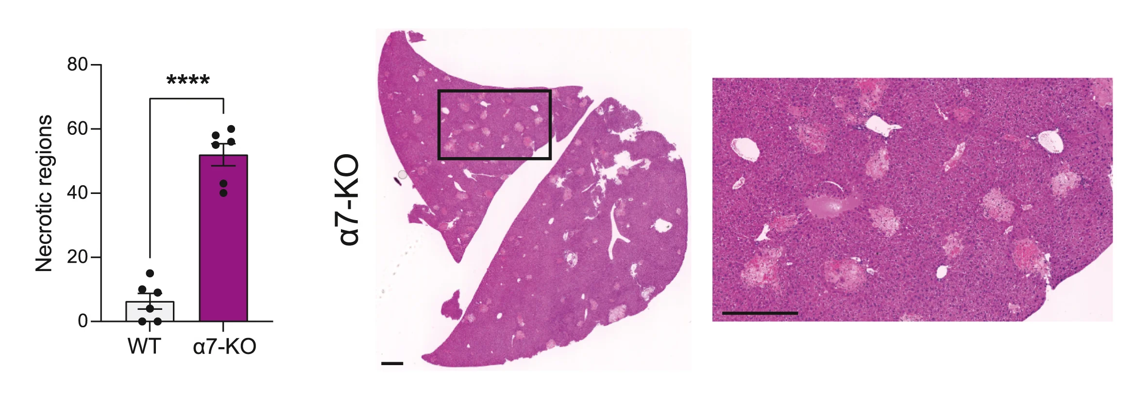 Open access visualization of Bar Plot, Error Bars, Microscopy, Necrotic Areas, Liver