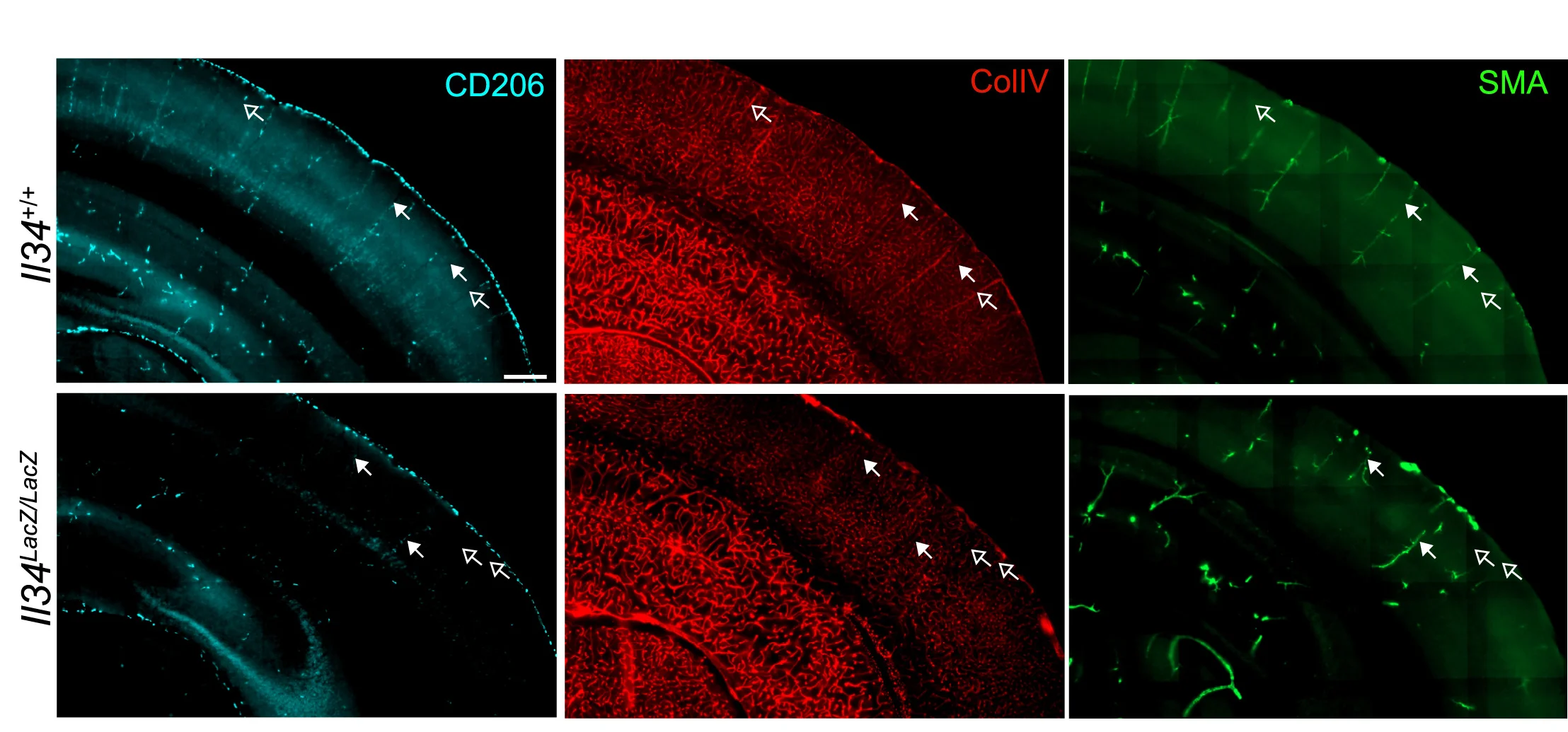 Open access visualization of Microscopy, Staining, Immunofluorescence, Blood Vessels, Arteries