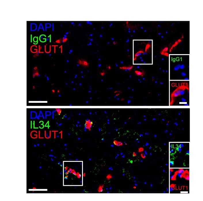 Open access visualization of Microscopy, Human Brain Sections, Anti-IL-34 Staining, IgG1 Isotype Control, Anti-GLUT1 Staining