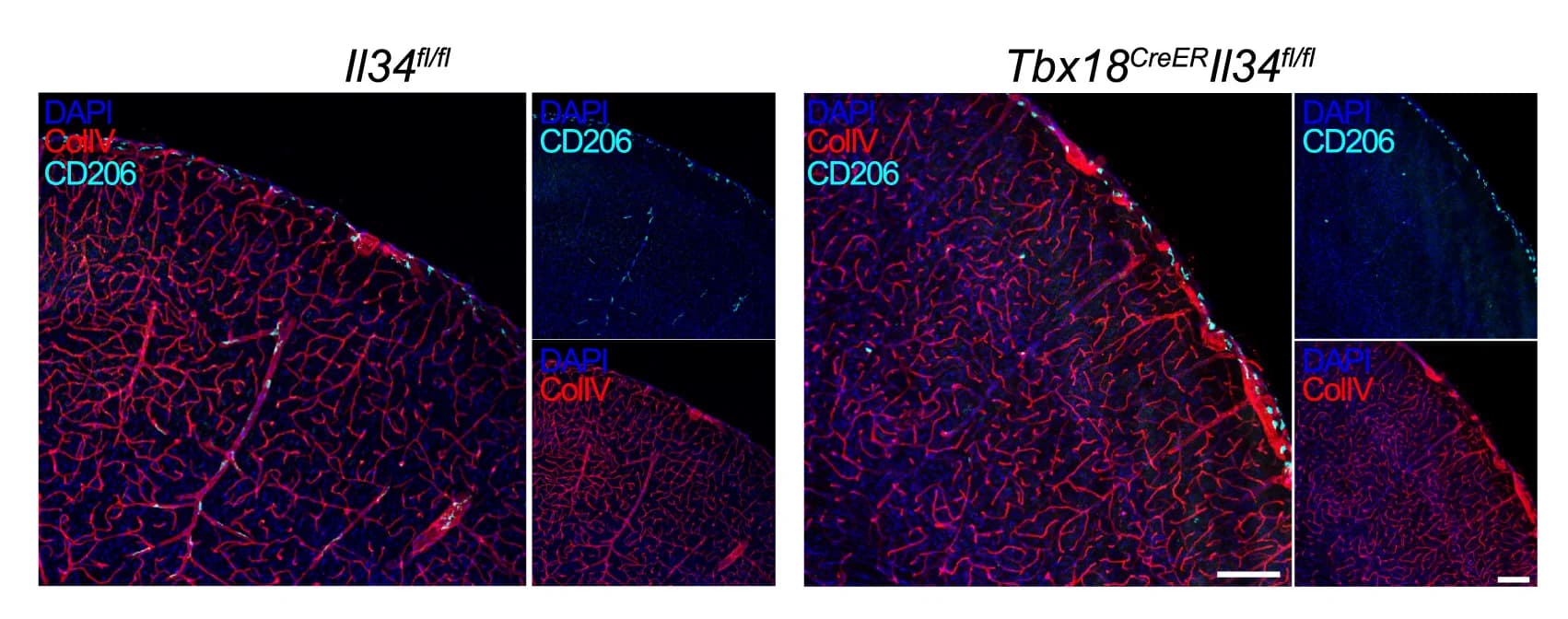 Open access visualization of Microscopy, Immunofluorescent Images, Tamoxifen-Treated Mice, CD206 Staining, ColIV Staining