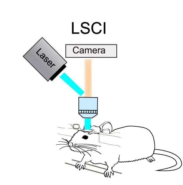 Open access visualization of Illustration, Workflow, Laser Speckle Contrast Imaging, LSCI