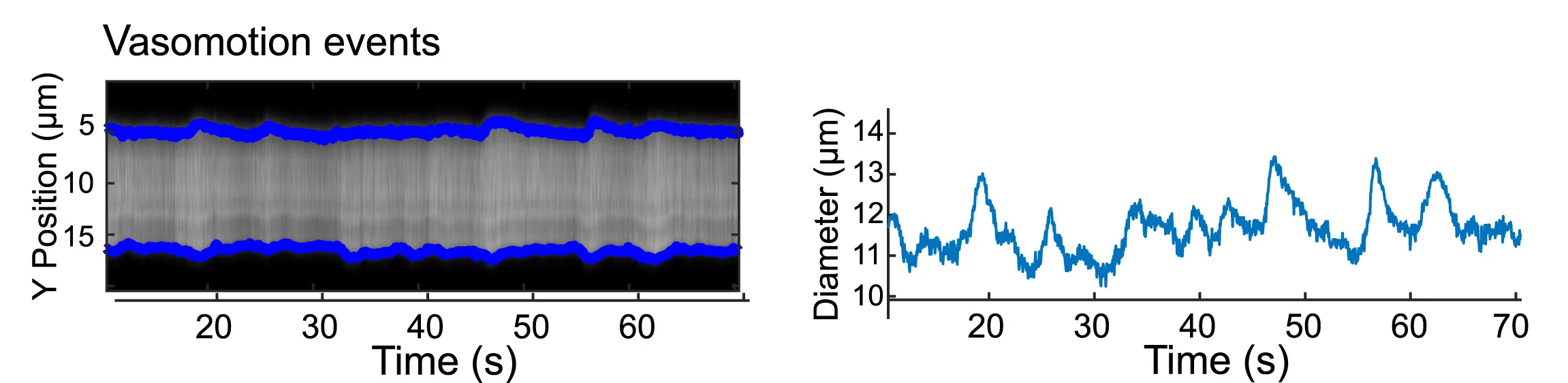 Open access visualization of Line Plot, Microscopy, Spontaneous Vasomotion Events, Artery, Diameter Plot