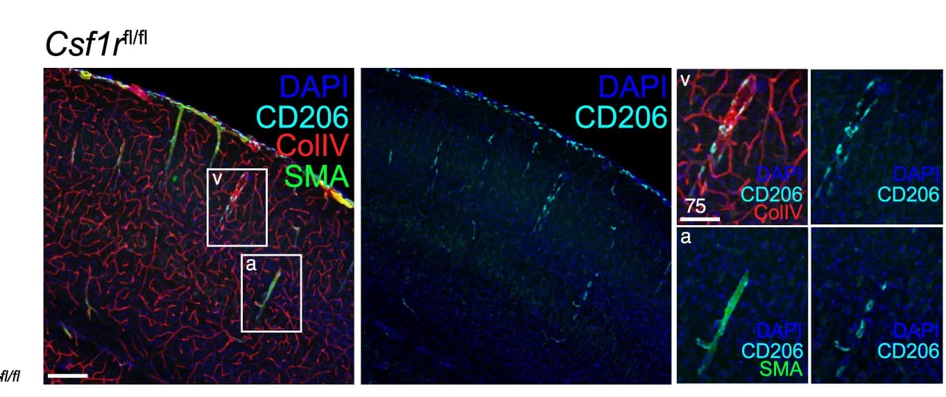 Open access visualization of Microscopy, Immunofluorescence, Brain Sections, Mice, CD206