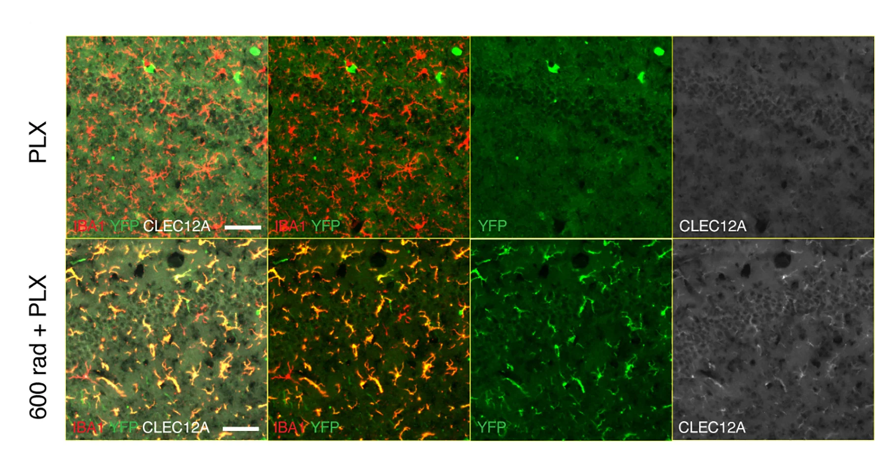 Open access visualization of Microscopy, Brain Sections, Flt3Cre:Yfpmice, IBA1, GFP