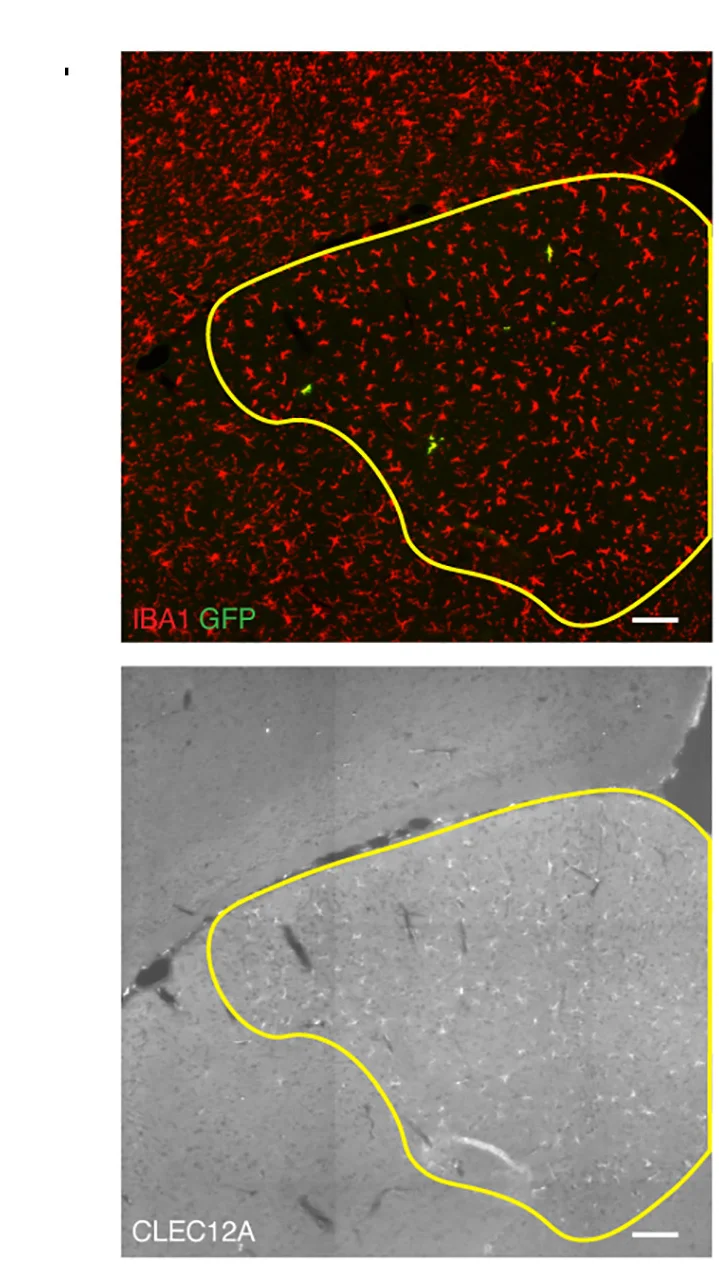 Open access visualization of Microscopy, Brain Section, PLX3397, IBA1, GFP