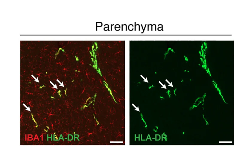 Open access visualization of Microscopy, Adult Blood, Mice, IBA1, HLA-DR