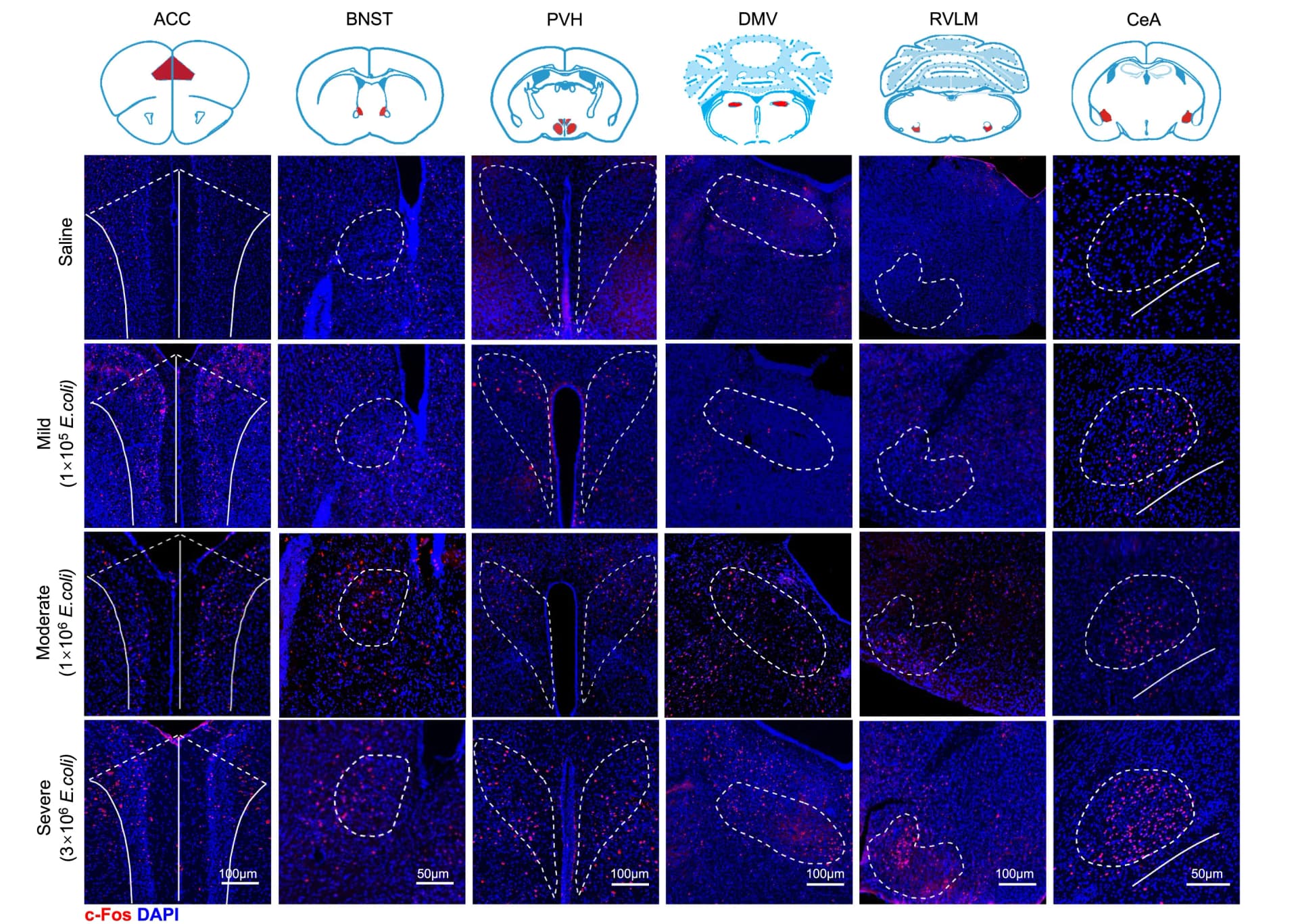 Open access visualization of Microscopy, c-Fos, Immunofluorescence Staining, Brain Regions, ACC