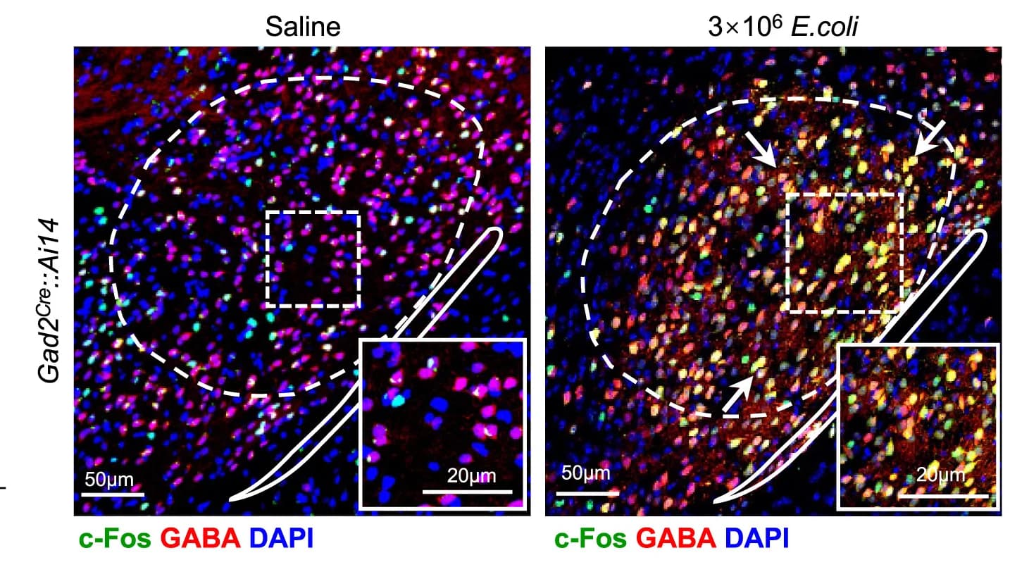 Open access visualization of Microscopy, Immunofluorescence, c-Fos Positive Neurons, GABA Positive Neurons, CeA
