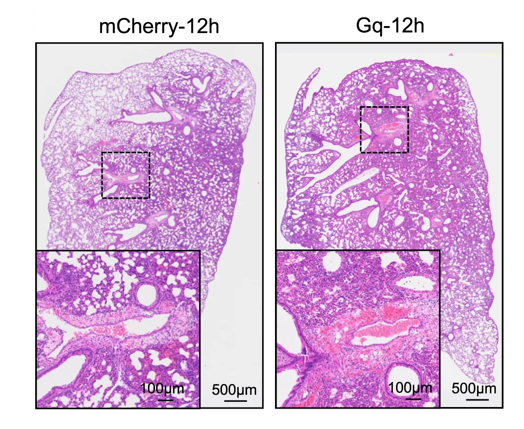 Open access visualization of Microscopy, Histology, Lungs, mCherry, Gq Treatment