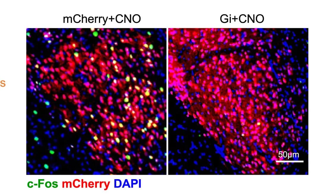 Open access visualization of Microscopy, Immunofluorescence, c-Fos, mCherry, DAPI