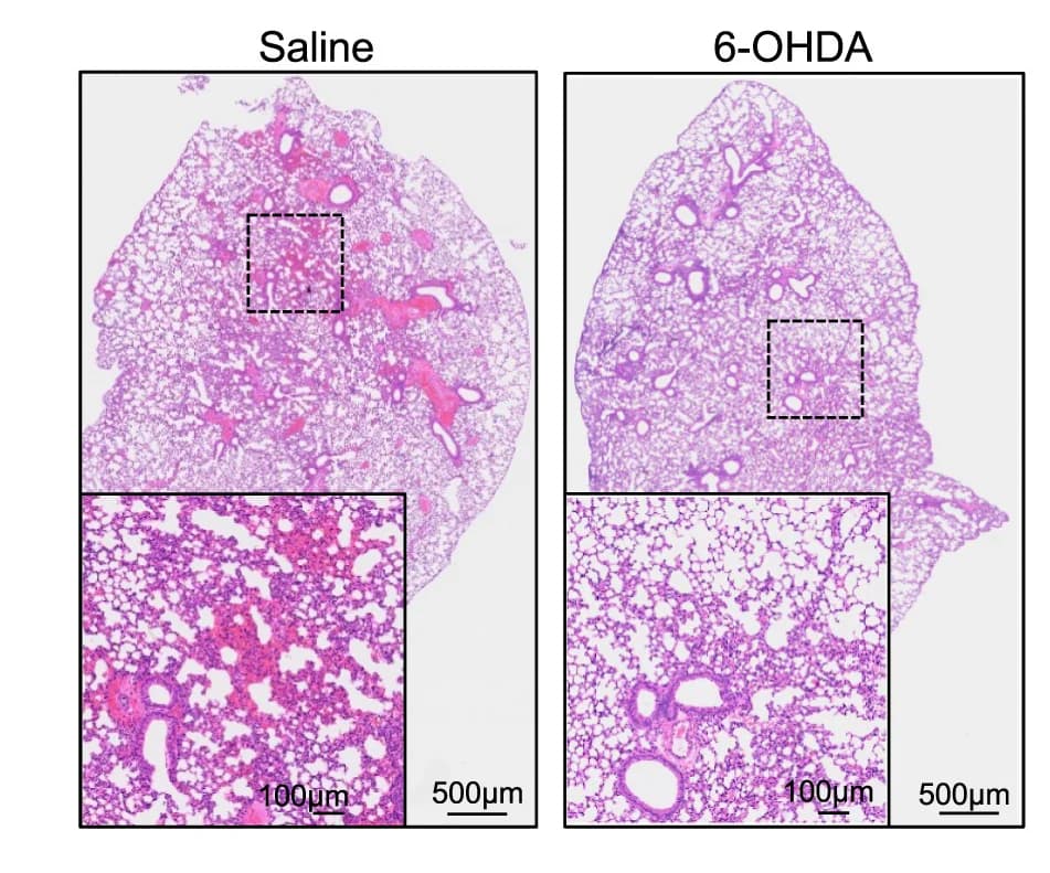 Open access visualization of Microscopy, Histology Images, Lungs, Control Mice, 6-OHDA Treated Mice