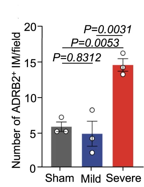 Open access visualization of Bar Plot, Error Bars, Quantification, CX3CR1, ADRB2