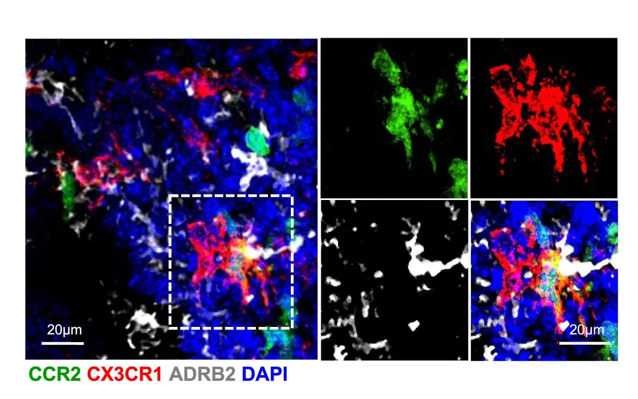 Open access visualization of Microscopy, IF Images, CCR2, CX3CR1, ADRB2