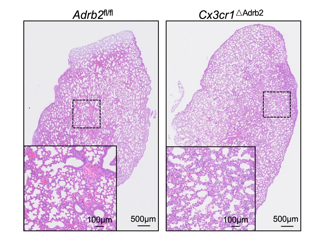 Open access visualization of Microscopy, Histology Images, Lungs, Adrb2fl/fl Mice, Cx3cr1Adrb2 Mice