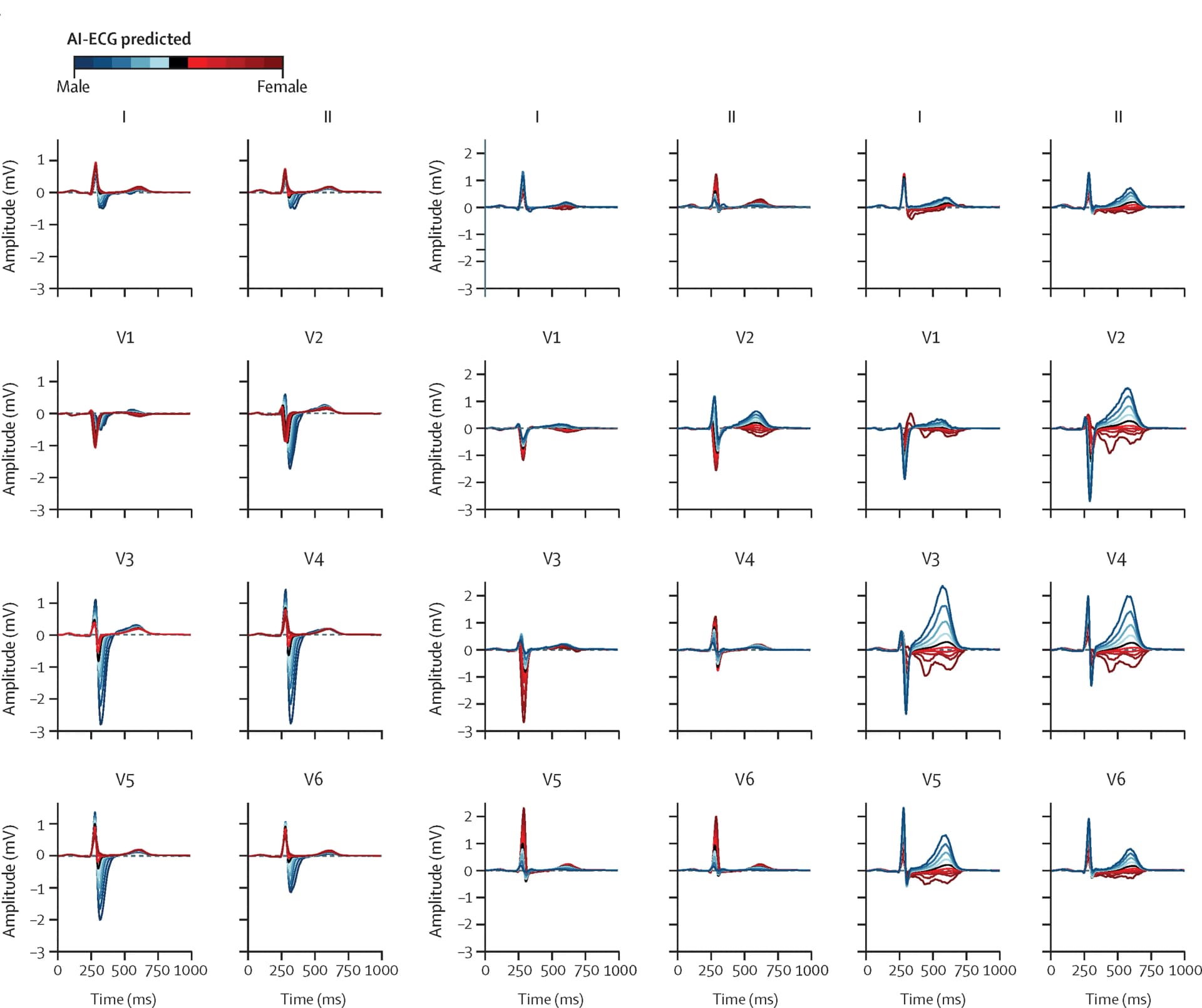 Open access visualization of Line Plot, Variational Autoencoder, Morphological Features, AI-ECG, Sex Prediction