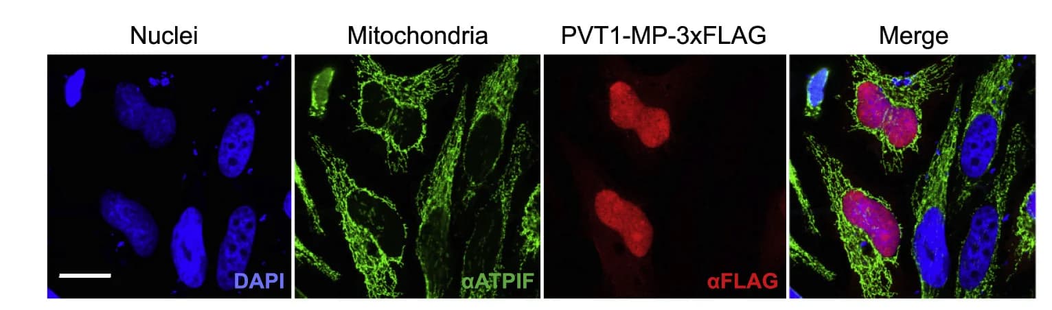 Open access visualization of Microscopy, Immunofluorescence, FLAG-tagged PVT1-MP, HeLa cells, Cell nuclei