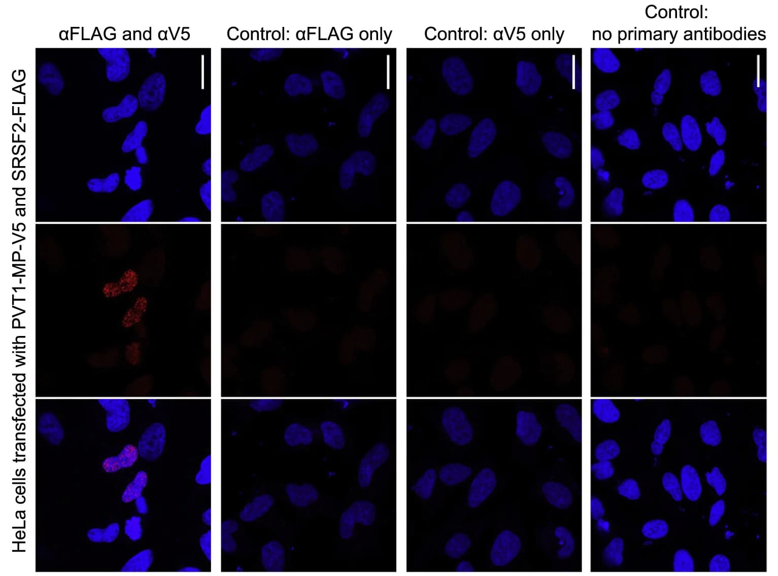 Open access visualization of Microscopy, PLA, HeLa cells, V5-tagged PVT1-MP, FLAG-tagged SRSF2