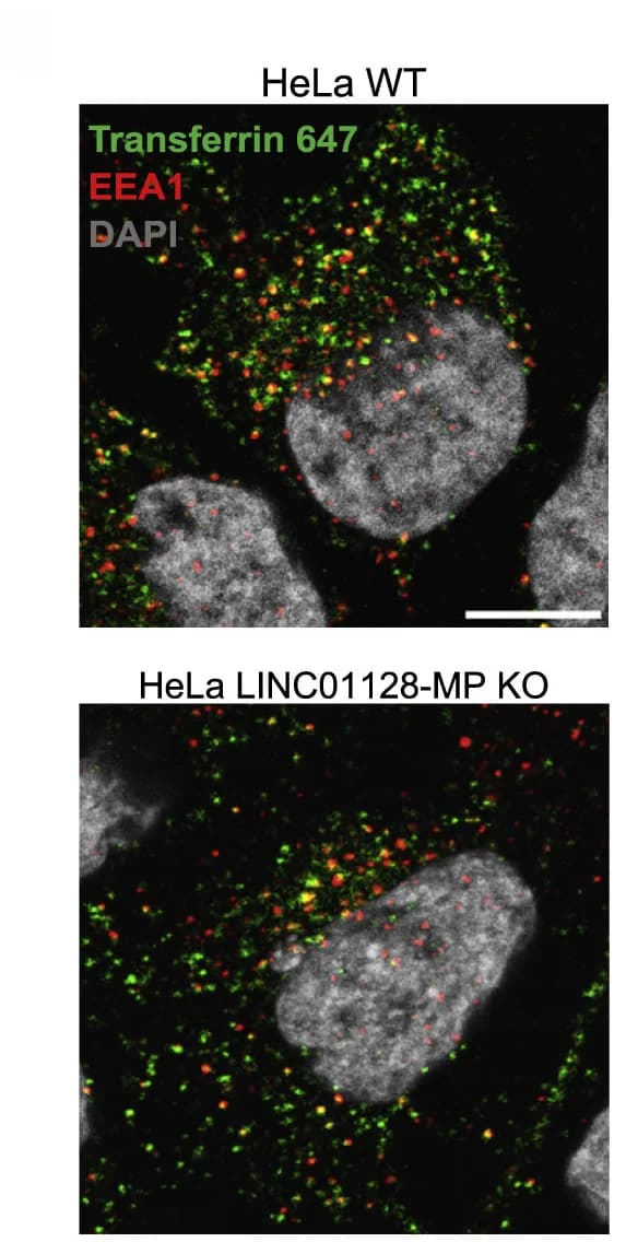 Open access visualization of Microscopy, Fluorescently labeled transferrin, EEA1, HeLa WT cells, LINC01128-MP knockout cells