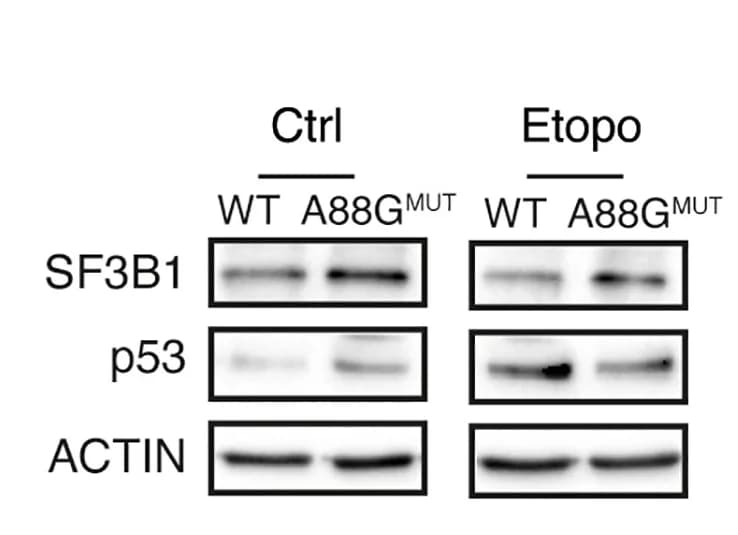 Open access visualization of Gel, SF3B1, p53 Protein Analysis, MOLM-13 Cells, Etoposide