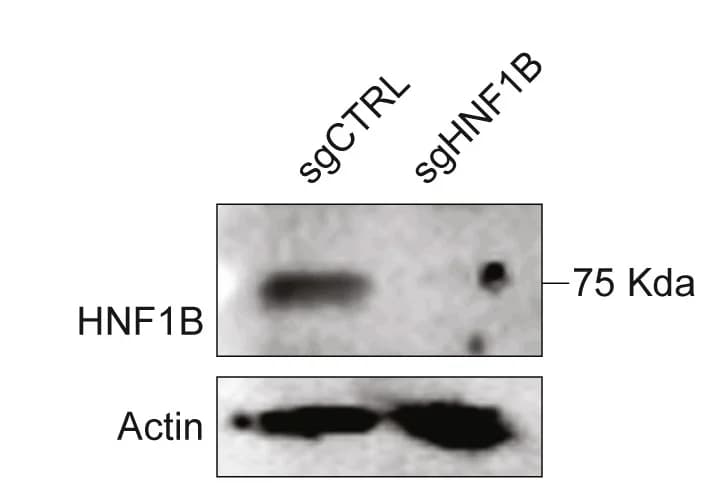 Open access visualization of Gel, Metascape Analysis, C6 Sites, HNF1B Binding, CUT&Tag