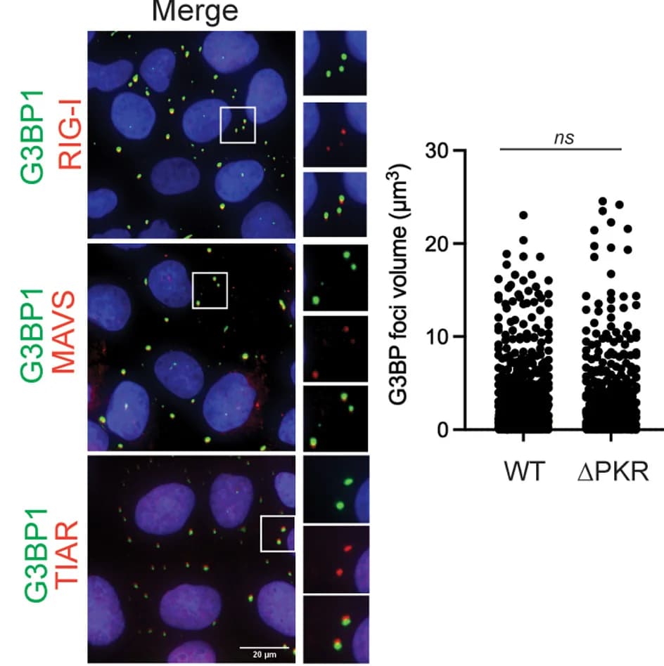Open access visualization of Microscopy, Scatter Plot, Colocalization, RIG-I, MAVS
