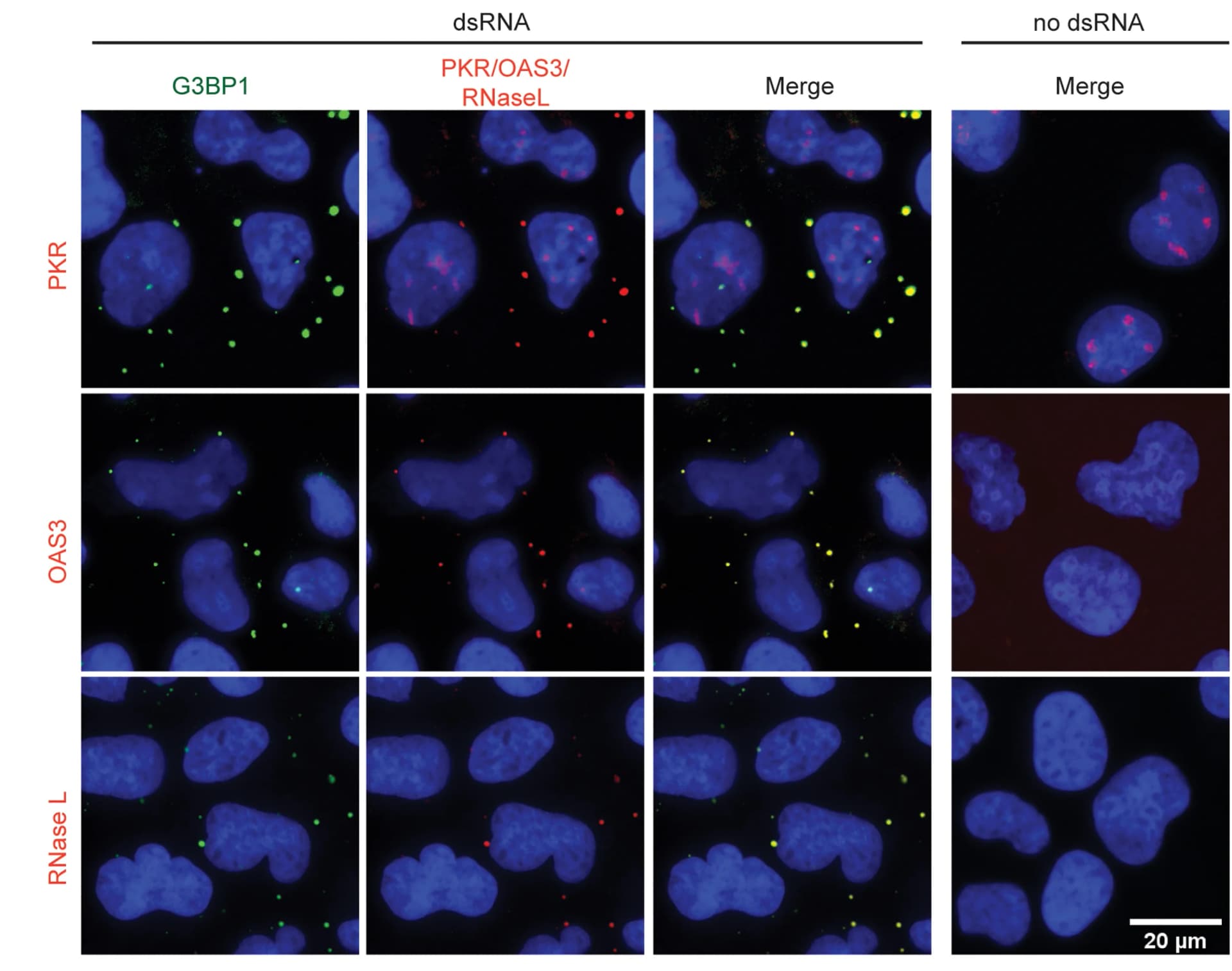 Open access visualization of Microscopy, IF analysis, PKR, OAS3, RNase L