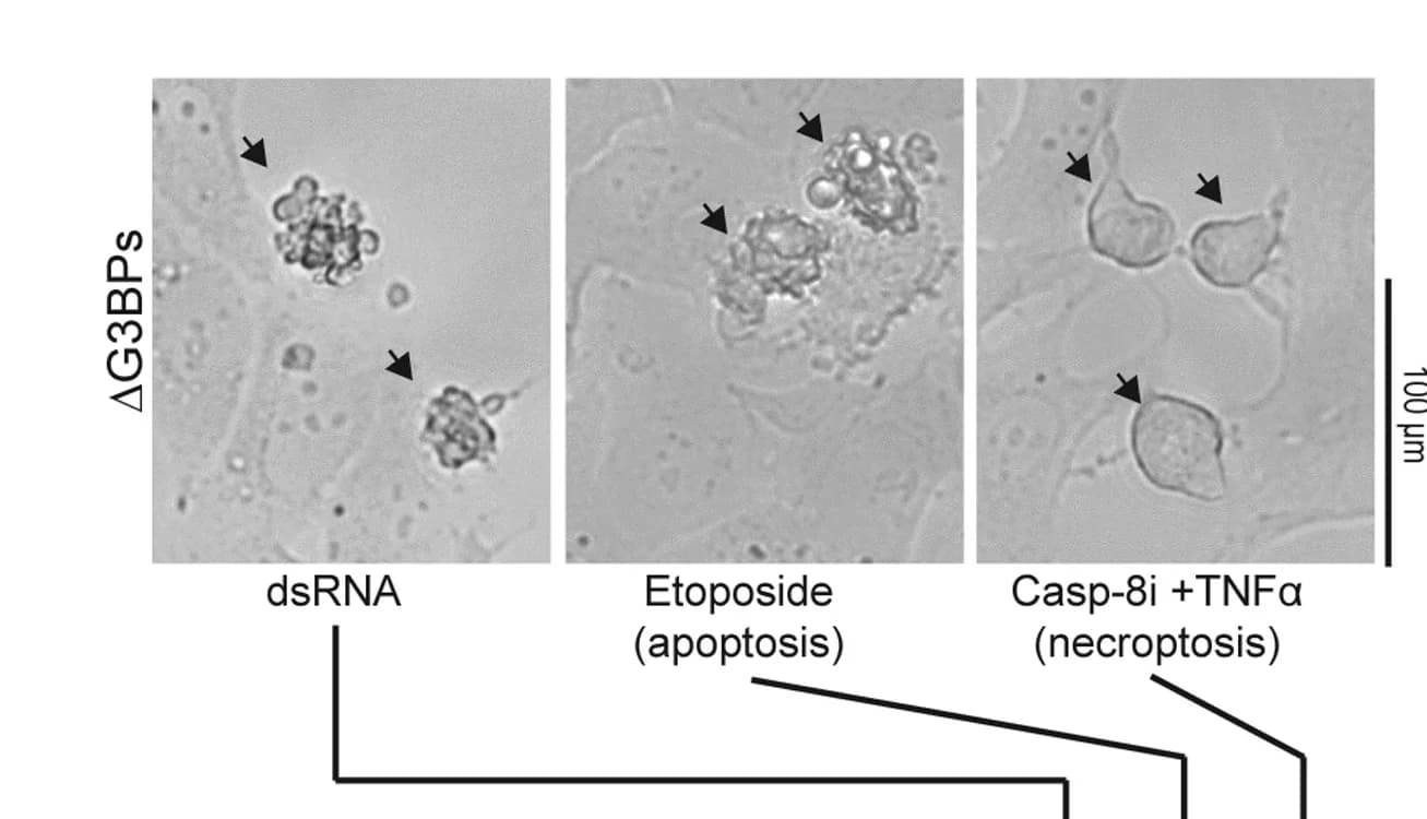 Open access visualization of Microscopy, Cell Death, dsRNA, Etoposide, Caspase-8 Inhibitor