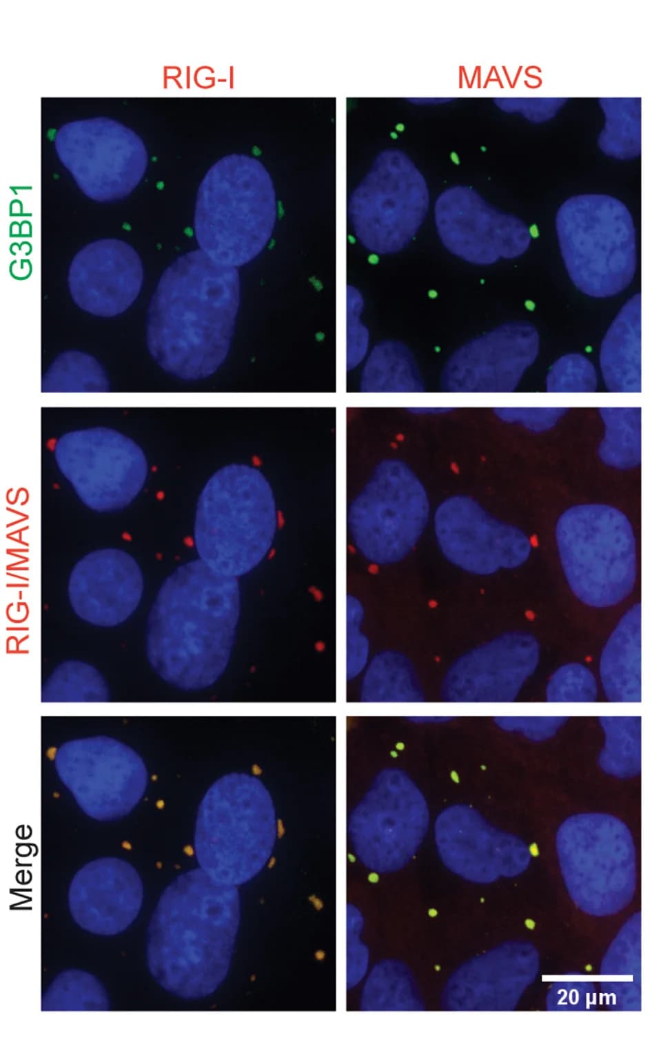 Open access visualization of Microscopy, IF, RIG-I, MAVS, G3BP1