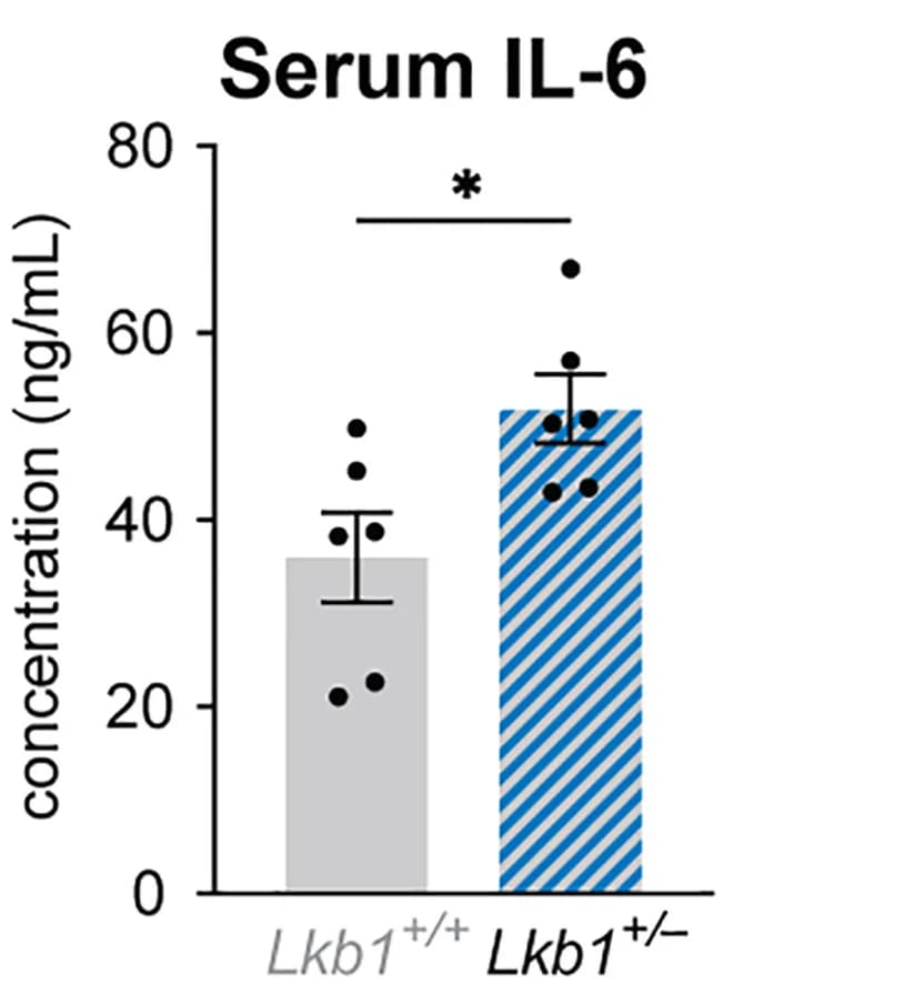 Open access visualization of Bar Plot, Error Bars, Serum IL-6 Levels, Control Mice, LKB1-mutant Mice