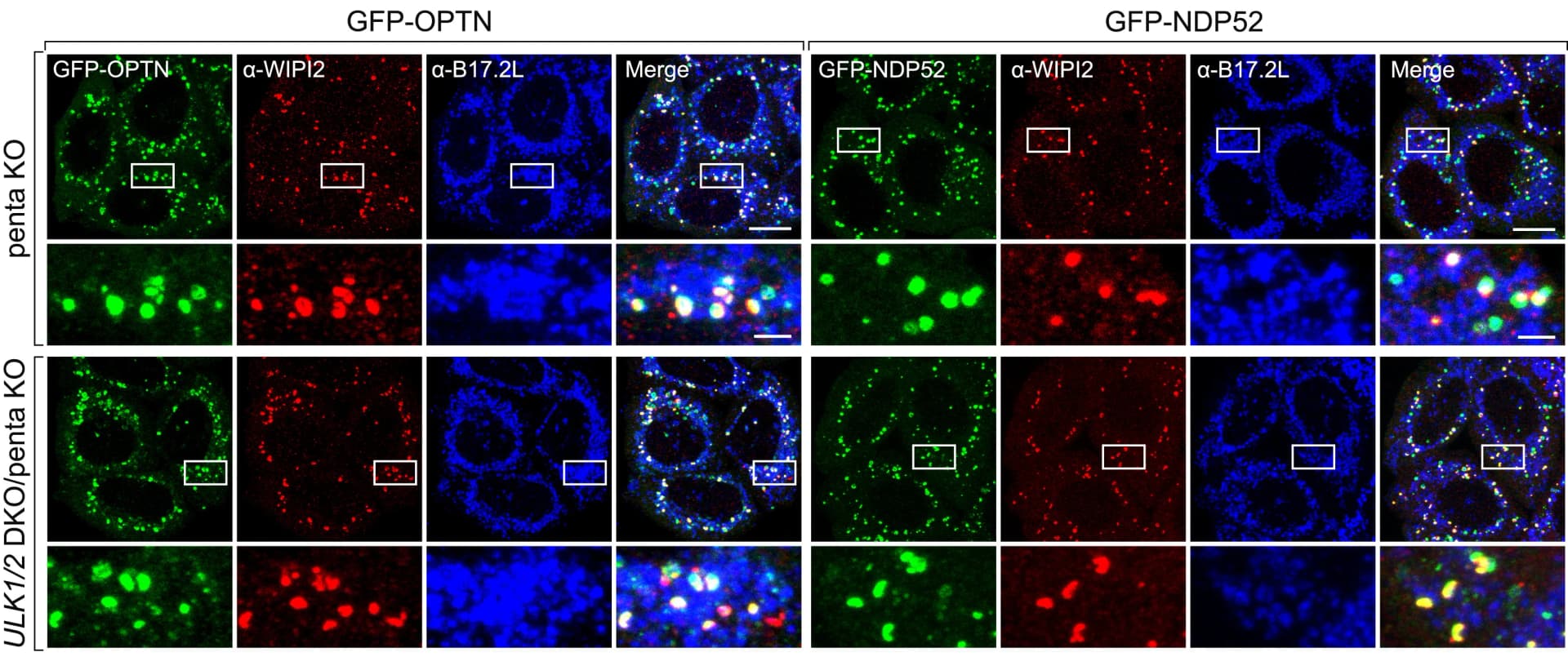Open access visualization of Microscopy, Cell lines, Immunostaining, WIPI2, B17.2L