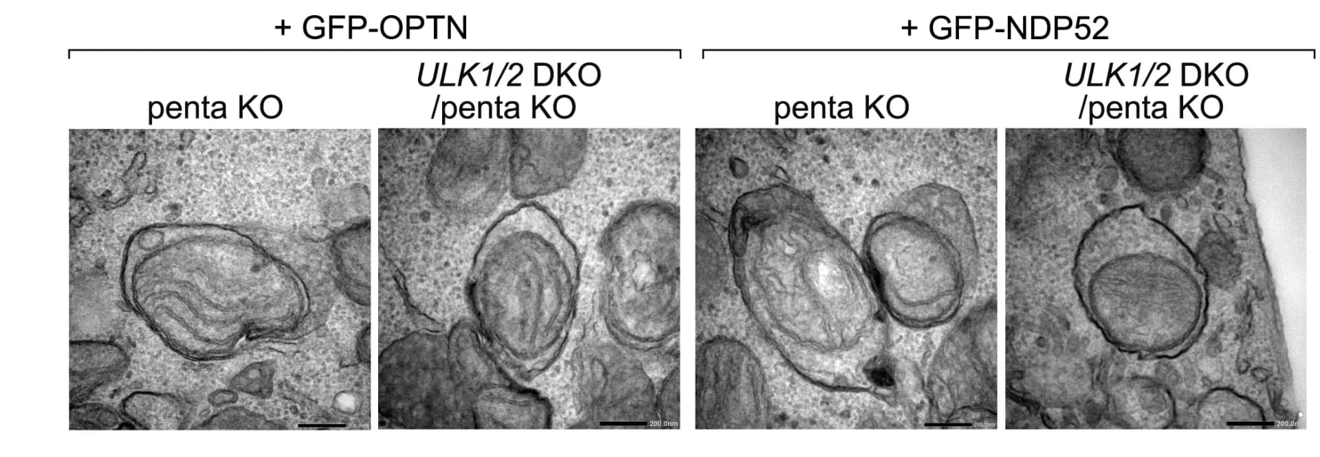 Open access visualization of Microscopy, Cell lines, Transmission Electron Microscopy, Mitochondria