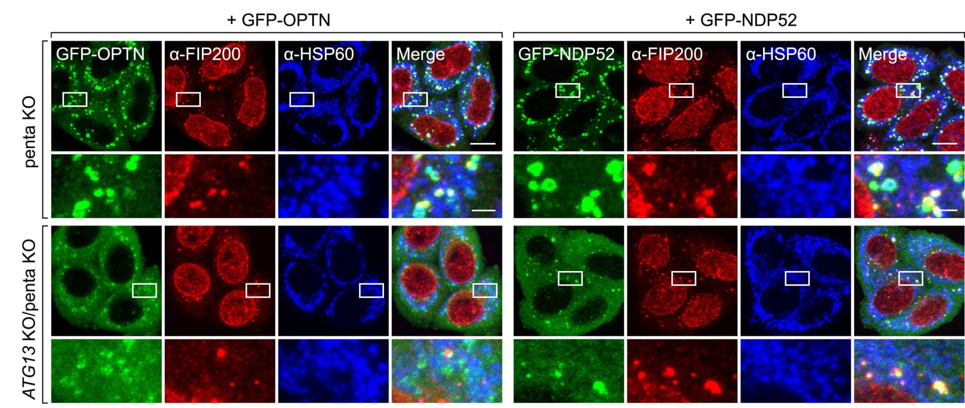 Open access visualization of Microscopy, penta KO, ATG13KO/penta KO, BFP-Parkin, GFP-OPTN
