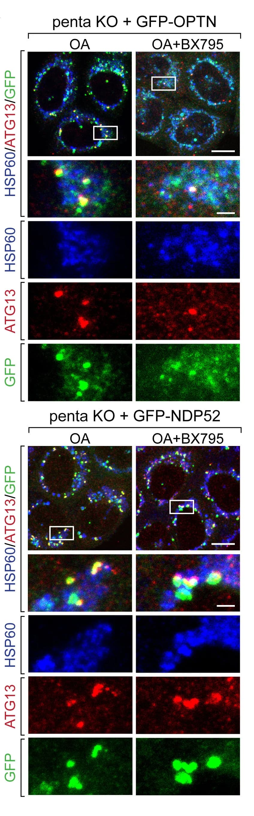 Open access visualization of Microscopy, penta KO Cells, GFP-OPTN, GFP-NDP52, OA
