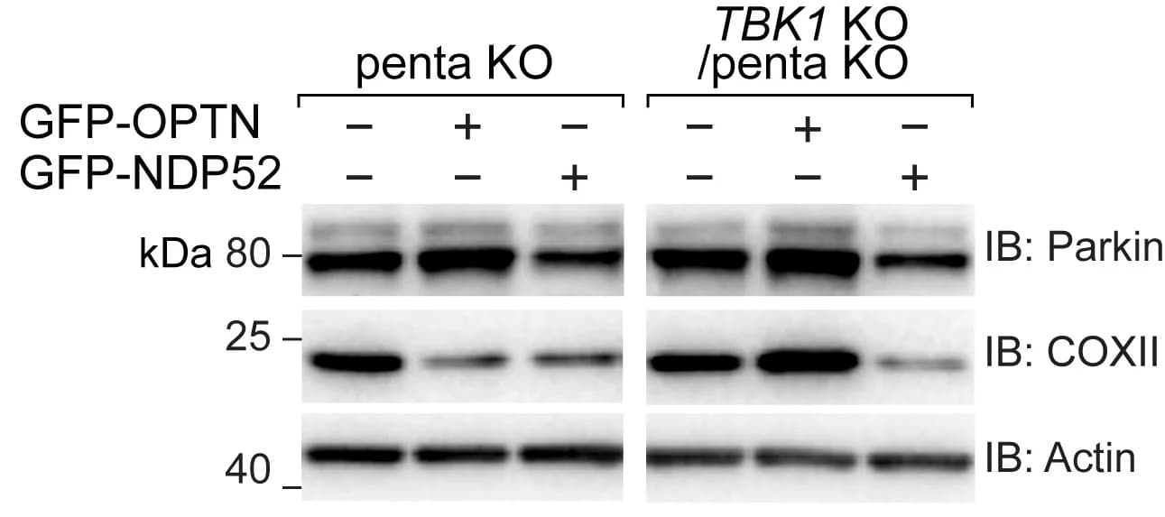 Open access visualization of Gel, penta KO, TBK1KO, BFP-Parkin, GFP-OPTN