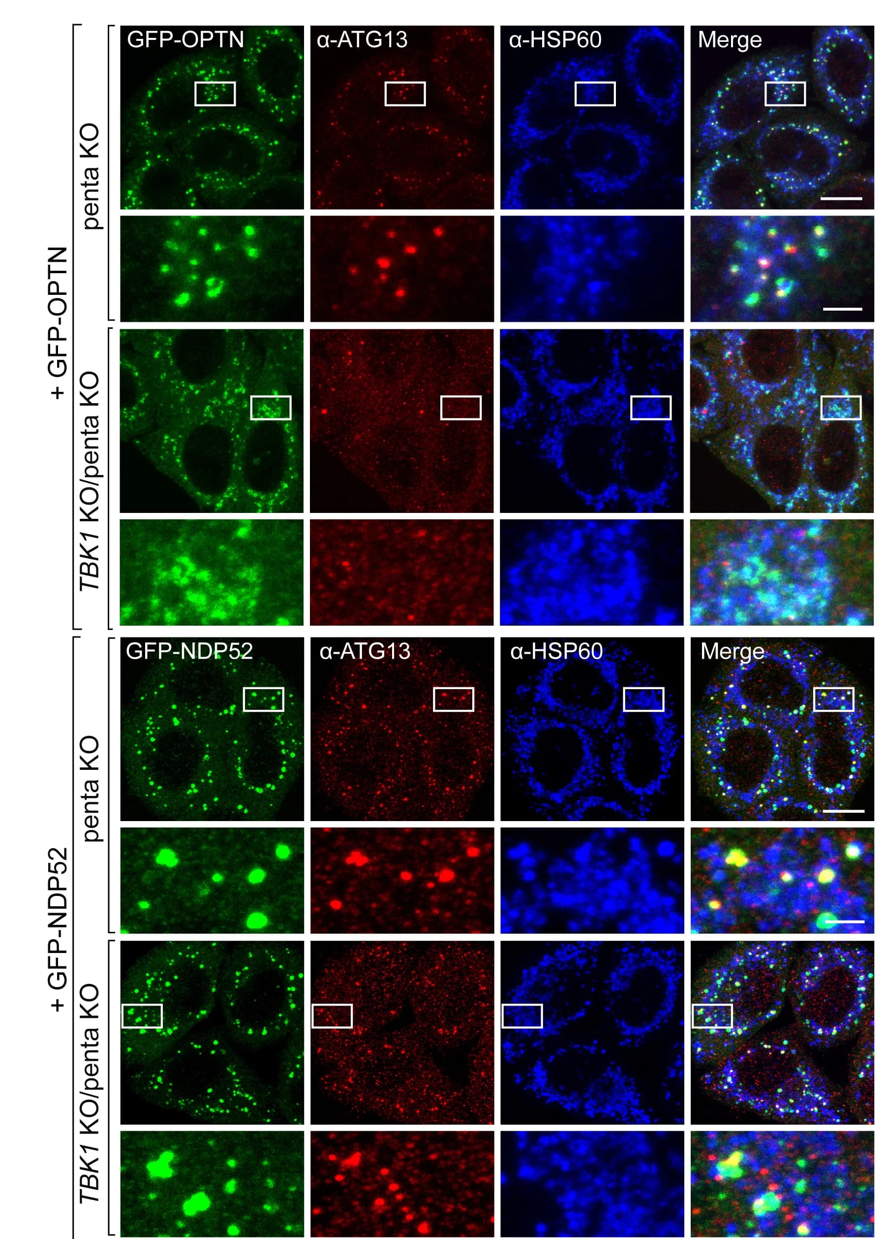 Open access visualization of Microscopy, penta KO, TBK1KO, BFP-Parkin, GFP-OPTN