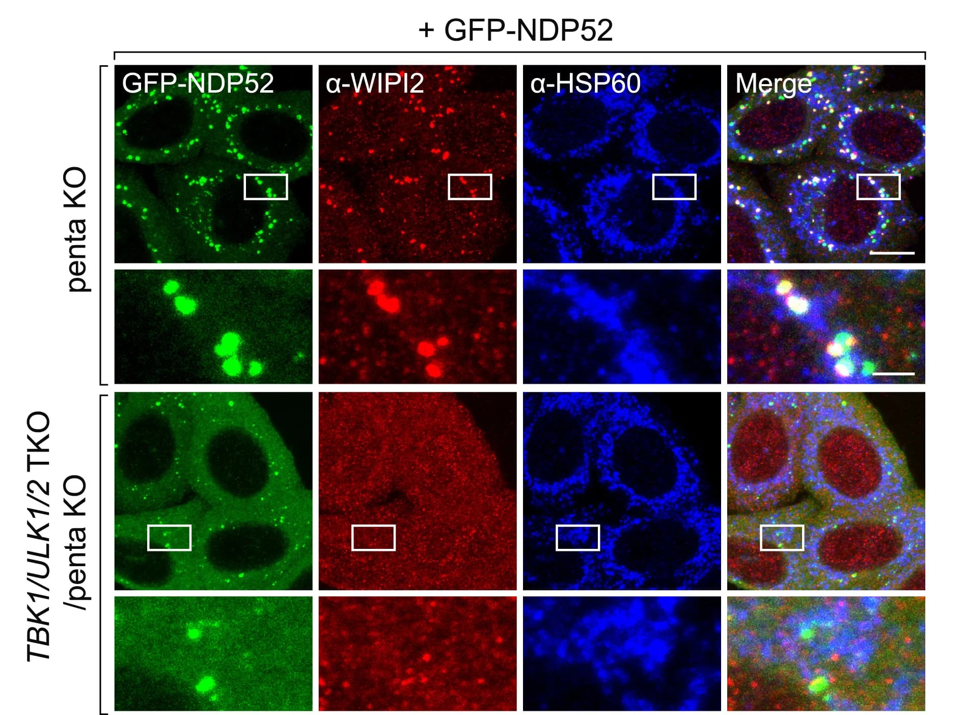 Open access visualization of Microscopy, Penta KO Cells, TBK1/ULK1/2TKO/Penta KO Cells, BFP-Parkin, GFP-NDP52