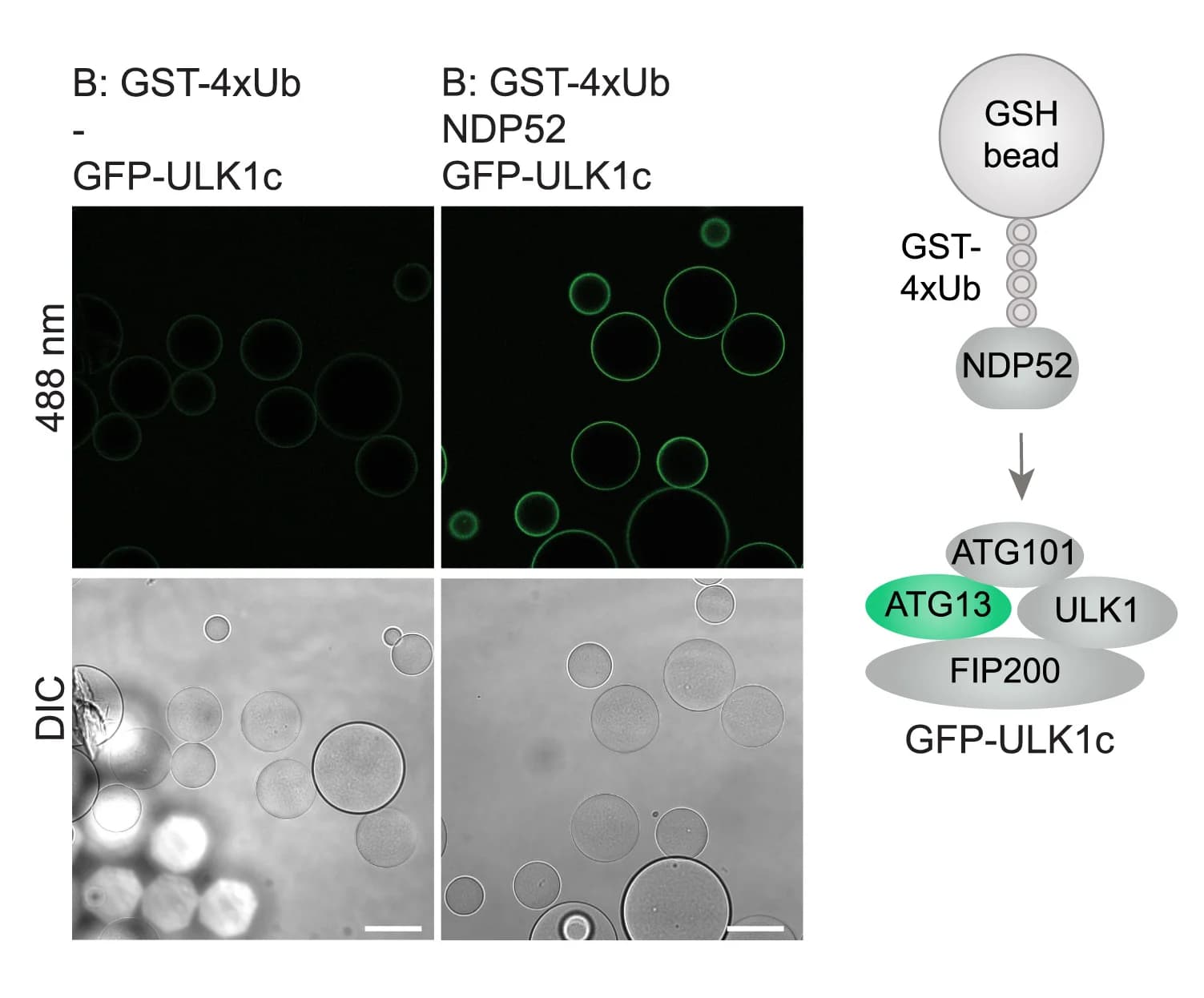 Open access visualization of Microscopy, Illustration, Workflow, Confocal Images, GFP-ULK1 Complex