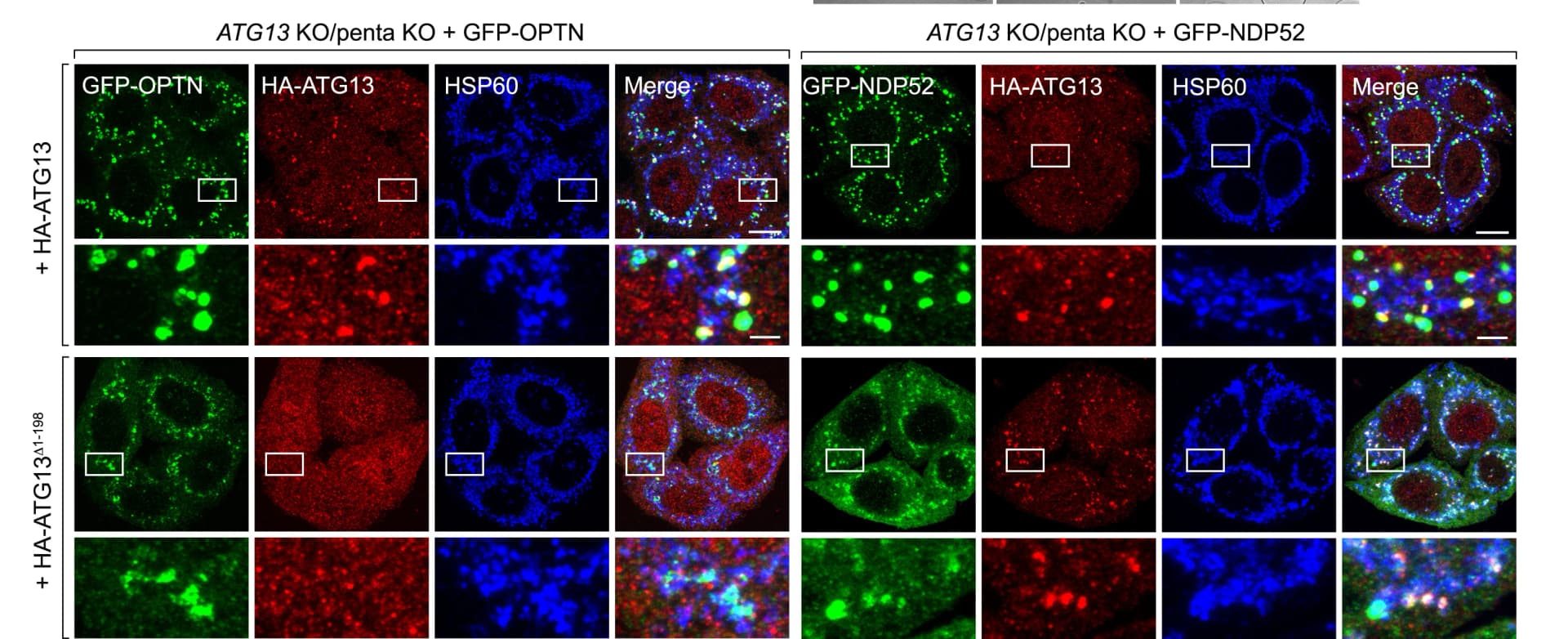 Open access visualization of Microscopy, ATG13KO/penta KO Cells, BFP-Parkin, GFP-OPTN, GFP-NDP52