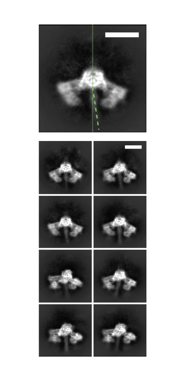 Open access visualization of Microscopy, Cryo-EM, 2D Class Averages, FERRY Complex, Coiled-coil Region