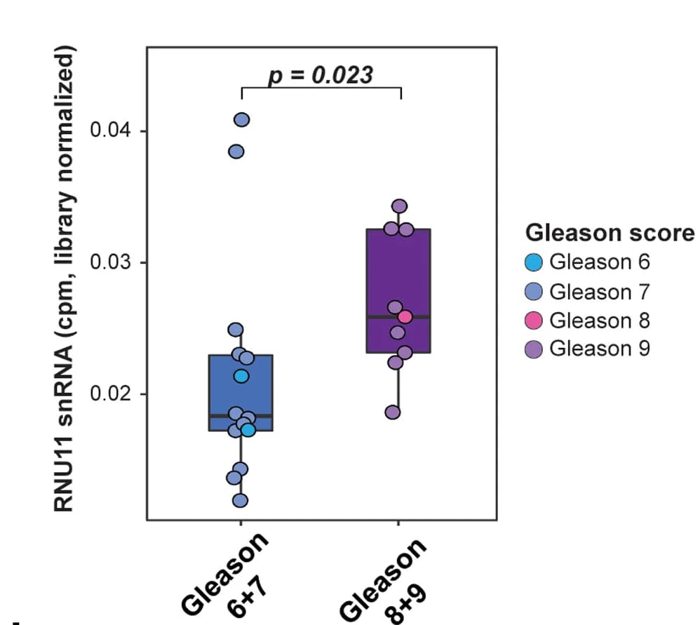 Open access visualization of Box Plot, Scatter Plot, Boxplots, RNU11 Expression, Primary Tumor Samples