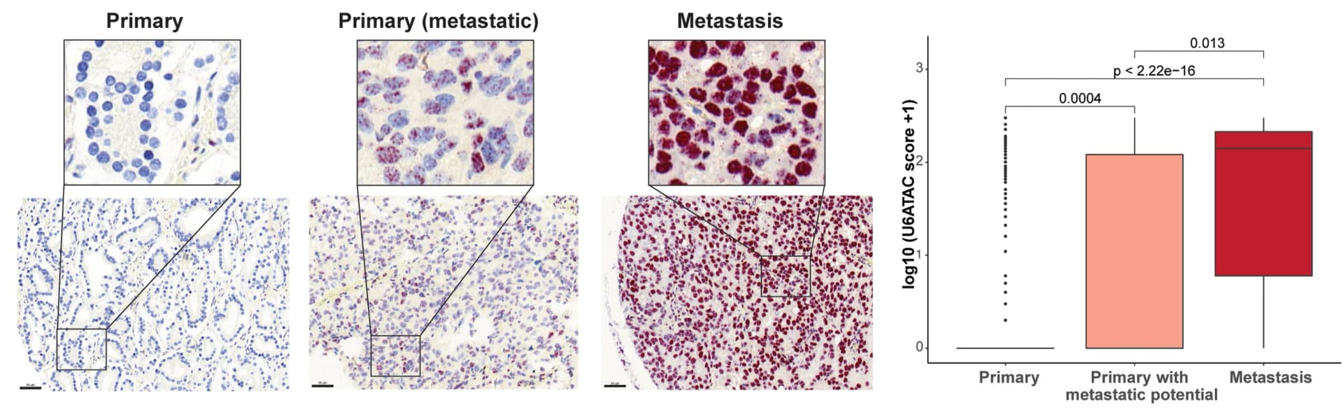 Open access visualization of Box Plot, Microscopy, Scatter Plot, RNU6atac BaseScope Probes, Human Primary Prostate Cancer Tissue