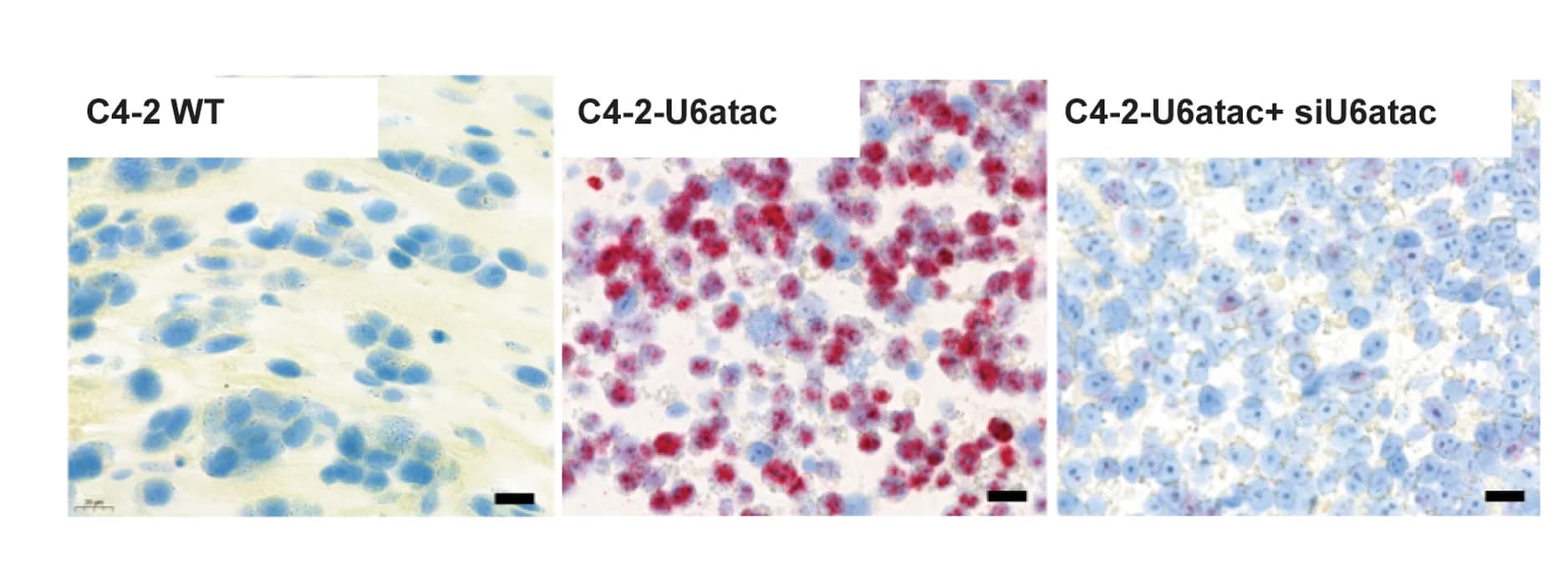 Open access visualization of Microscopy, RNU6atac BaseScope Probes, C4-2 Wild-Type Cells, U6atac Overexpression, siU6atac RNA